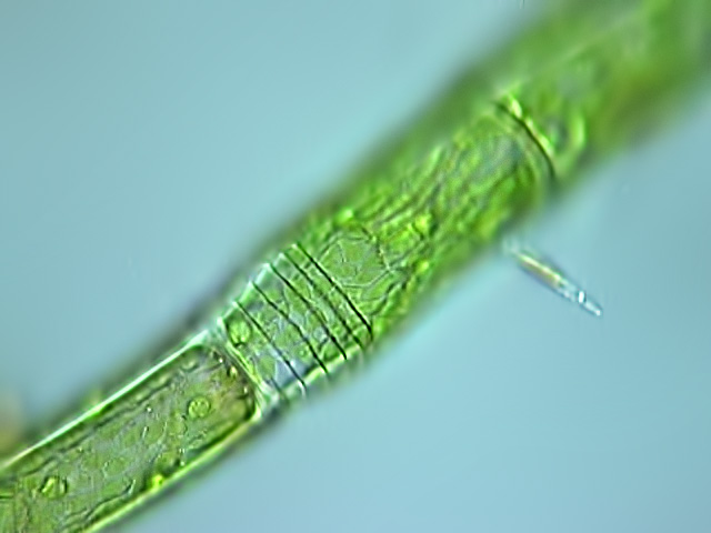 Leben im Teich die KappenGrünalge (Oedogonium sp.) (Chlorophyta)
